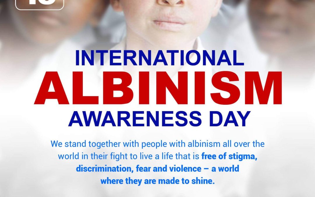 International Albinism Awareness Day